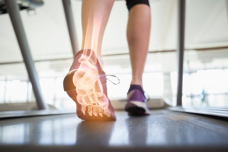 Digital composite of Highlighted foot bones of jogging woman