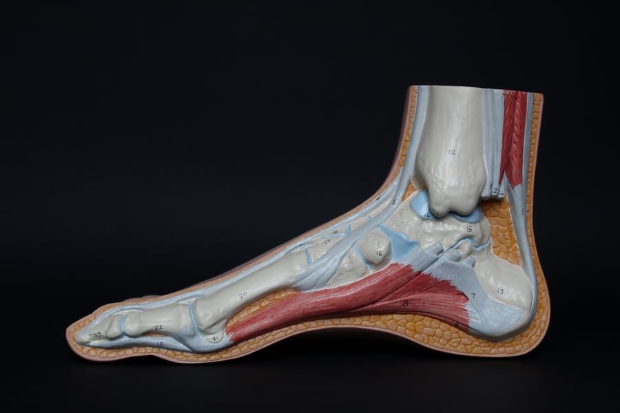 Sweeney Foot & Ankle What is Achilles Heel Pain and Tendonitis Diagram of Inside Foot