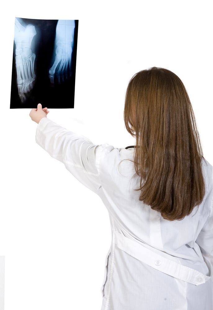 female doctor looking at an Xray over a white background