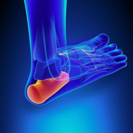 foot-x-ray.jpg