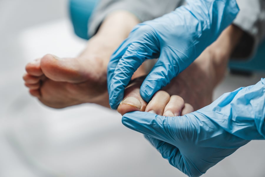 Podiatrist treating toenails
