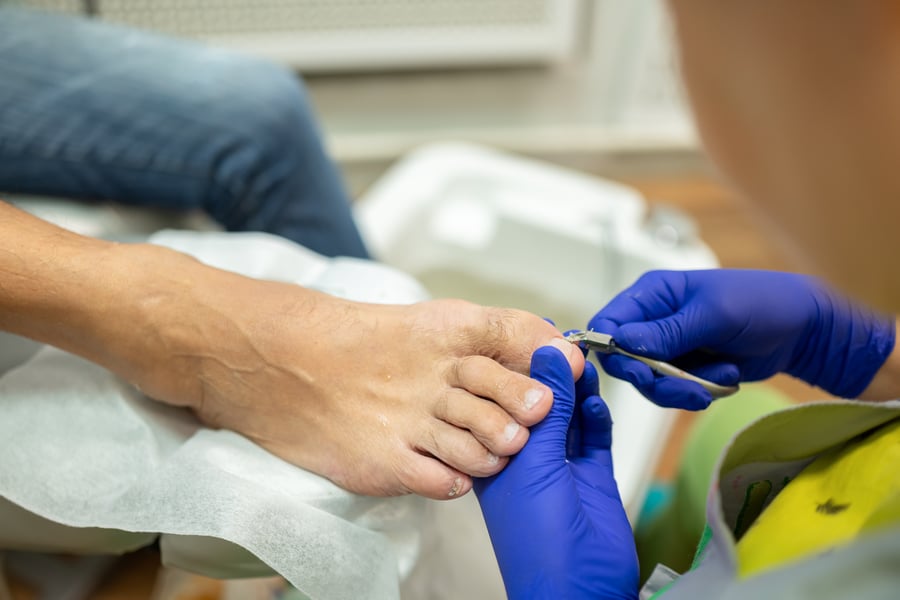 Doctor removing ingrown toenail from man