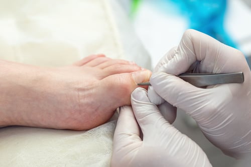 A podiatrist looking at a toe