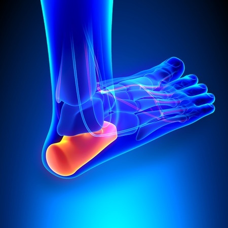 plantar foot heel pain.jpg